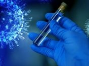 У Київській області за добу виявлено 30 нових випадків коронавірусу