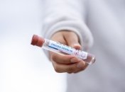 Ще одна людина померла від коронавірусу на Кіровоградщині