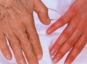 Холодные руки и ноги могут быть сигналом опасной болезни