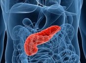 Ранние признаки, свидетельствующие о раке поджелудочной железы