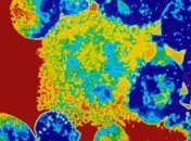 Ученые обнаружили гигантские бронированные вирусы