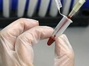 В Николаеве обнаружили возбудитель опасного заболевания 