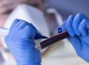 В Украине разработали уникальный тест для выявления коронавируса и гриппа