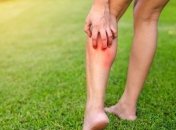 Врачи рассказали о смертельной опасности тромбоза