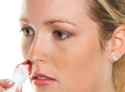 Первая помощь при носовом кровотечении