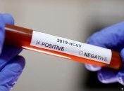 Количество заболевших за сутки коронавирусом в Украине исчисляется тысячами