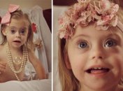 Двухлетняя девочка с синдромом Дауна стала моделью