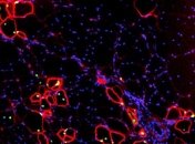 Стволовые клетки человека превратили в предшественников мышечной ткани