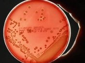 Ученые создали антибиотик, который убивает опасные бактерии