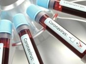 В Україні вже - 20 580 випадків коронавірусу