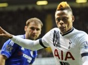 Полузащитник "Тоттенхэма" получил травму