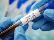 Маски знімати зарано, Україну може накрити ще одна хвиля коронавірусу, - лікар Тарас Жиравецький