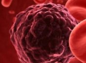 Мутации в ряде генов увеличивают риск развития рака у детей