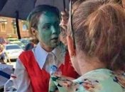 У Королевской диагностировали ожог глаза и частичную потерю зрения