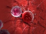 Разработан новый способ борьбы с раковыми опухолями