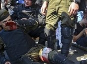 Порошенко посетит раненных под Радой нацгвардейцев