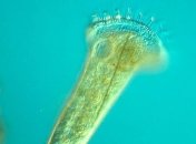 Не такие и простые: одноклеточные могут запоминать опасные вещества