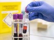 Коронавирус в Украине: за сутки - 800 новых случаев