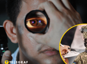 С какими болезнями глаз не берут служить