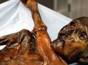 Ученые обнаружили вредоносную бактерию в мумии Эцы