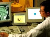 Ученые вырастили мозг "в пробирке"