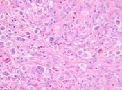 В США ученые нашли новый вид супербактерий, стойких к антибиотикам