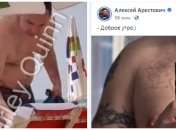 Арестович показал живот на фото