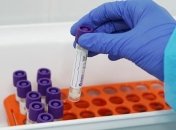 Эпидемия коронавируса: в Винницкой области выявили уже более 880 случаев COVID-19