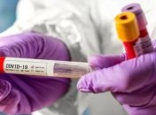 У ЗСУ за добу зафіксували два нових випадки коронавірусу