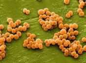 Отравление во Львове: в блюдах ресторана обнаружили золотистый стафилок