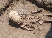 В Крыму обнаружили младенца с сильно вытянутым черепом