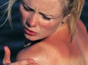 Обязательные шаги после получения солнечного ожога   