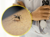 Переносниками хвороби є не тільки комарі