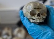 В XIX веке анатомы учились на телах младенцев