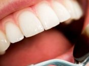 Восемь советов, как сохранить здоровье зубов