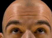 Рано лысеющие мужчины могут серьезно заболеть