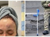 За словами дівчини, працівник ТЦК напав на неї