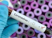 COVID-19: за минувшие сутки во Львовской области два летальных случая