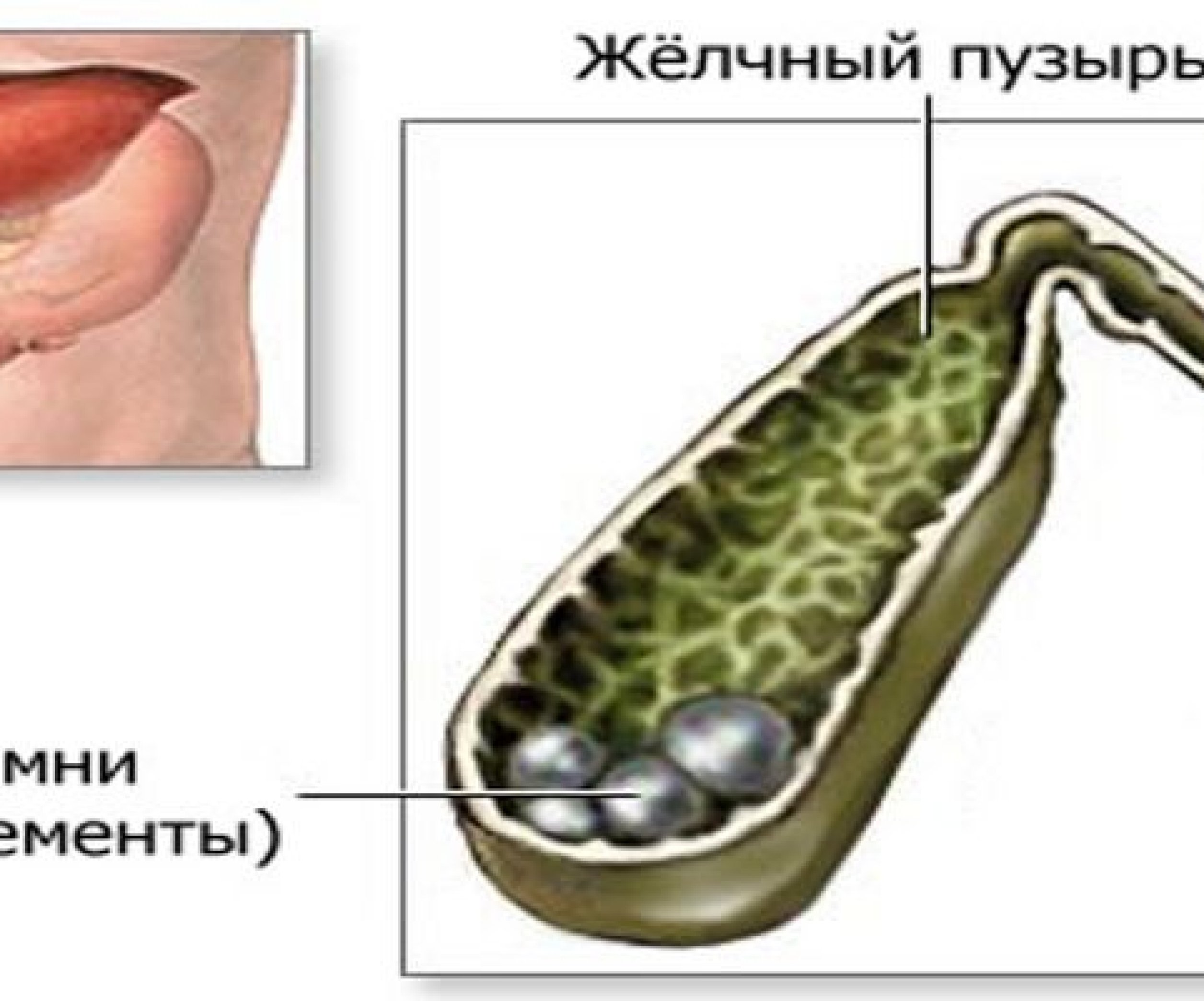 Эти два продукта эффективны для профилактики от камней в желчном пузыре -  Телеграф