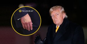 Дональд Трамп знову ховає синці на руках