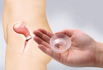 7 ненадежных методов контрацепции