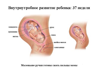 Артериальная гипертензия у беременных - причины, диагностика, лечение, профилактика