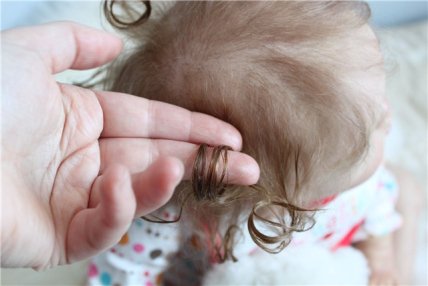 Выпадение волос у детей после COVID-19: причины и рекомендации