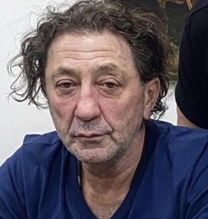 григорий лепс после пластики