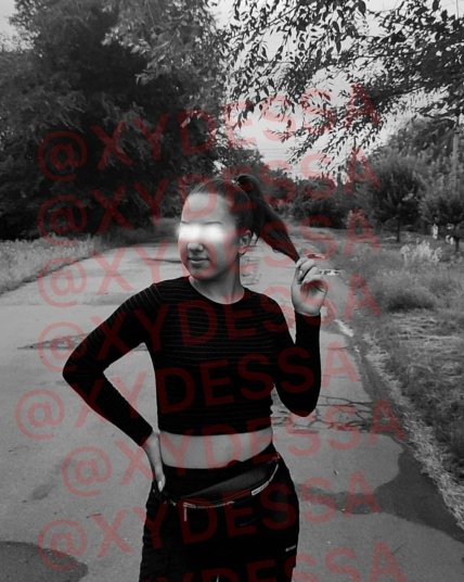 Смерть девочки под Одессой