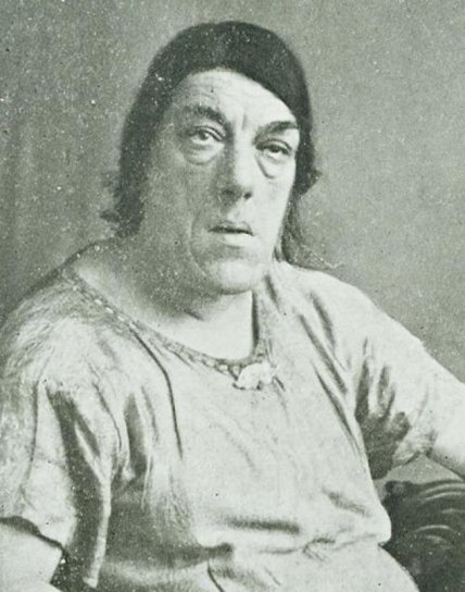 "Найпотворніша жінка світу" Мері Беван