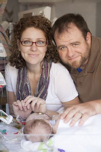 Врачи успешно разделили сиамских близнецов (ФОТО) - изображение №2