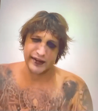 Ігор Комаров з ознаками катувань