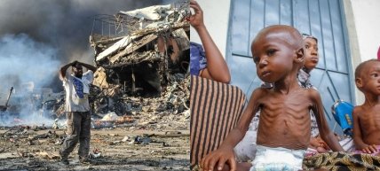 Фото голода в Сомали