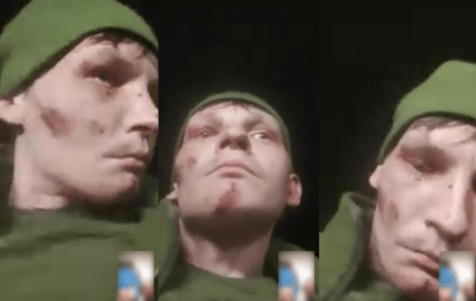 Сліди побоїв на особі військового Олександра Жікіна